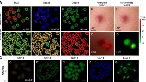 Intense pulsed light rejuvenates UVB-induced photoaging in human keratinocytes and guinea pig skin by inhibition of ERK-AP-1-MMP pathway