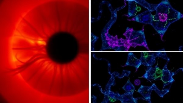 From BEST1 mutations to retinal regeneration: integrating stem cell–derived RPE models and gene correction strategies