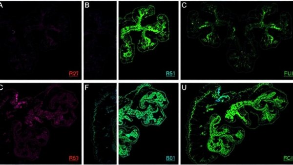 Correction: Deficient or R273H and R248W mutations of p53 promote chemoresistance to 5-FU via TCF21/CD44 axis-mediated enhanced stemness in colorectal carcinoma