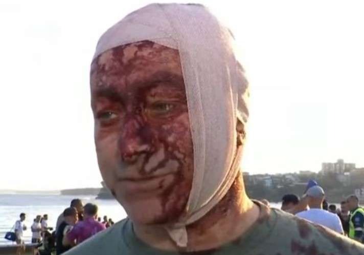 Emergency responders aid injured person at night.