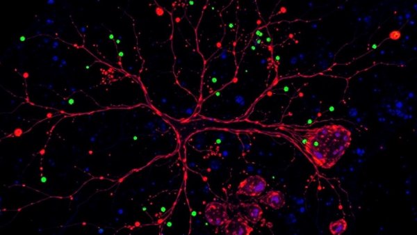 Fluorescent neural tissue illustrating nervous system repair in spinal cord injury.