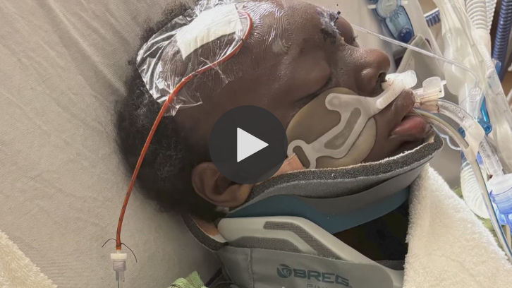 Person receiving medical care after hit-and-run incident in Harris County.