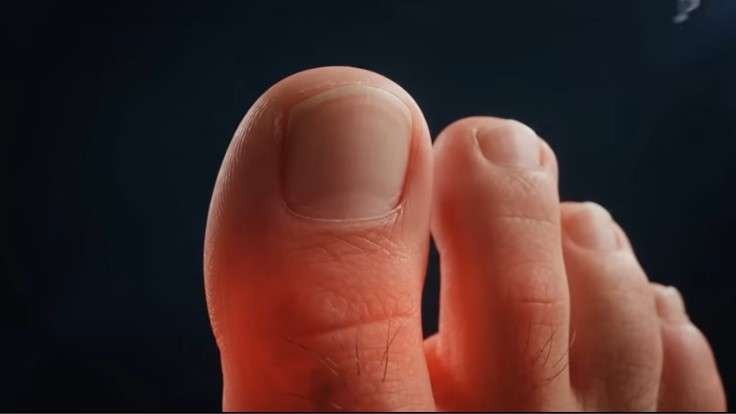 Toenail fungus remedies image, close-up with treatment dropper.
